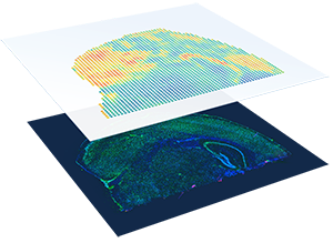 空間オミクスソリューションVisium, Xenium
